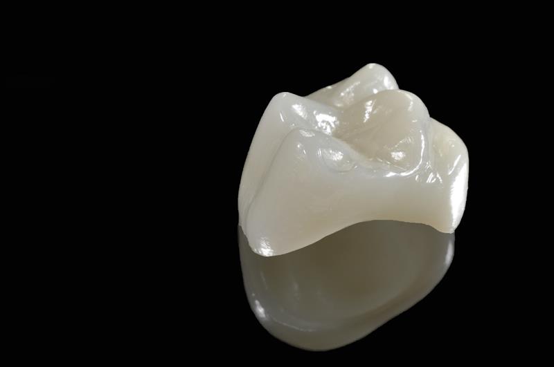 Porcelain Crowns  Roanoke, VA 